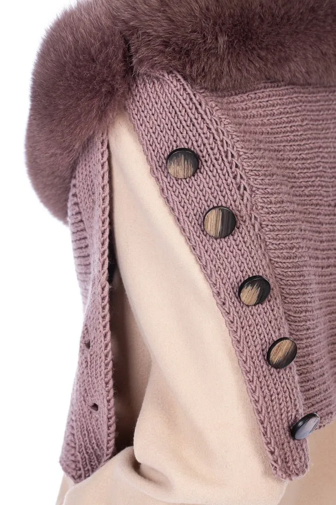 Stole Trimmed With Fox Fur